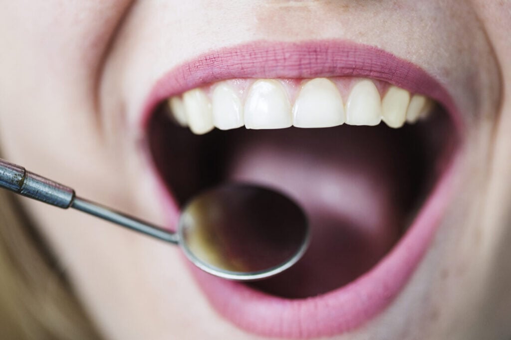 open-mouth-woman-with-dentist-mirror